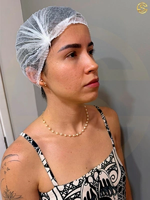 Foto antes e depois