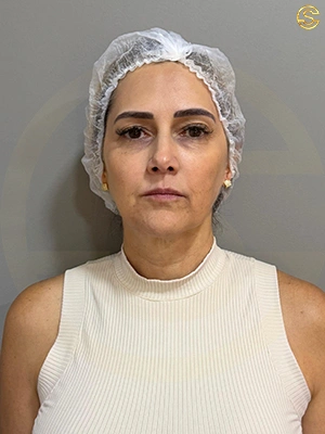 Foto antes e depois