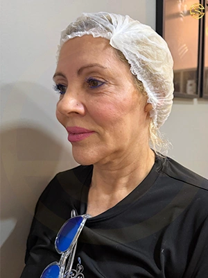 Foto antes e depois