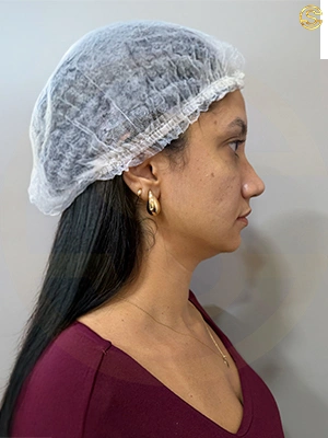 Foto antes e depois