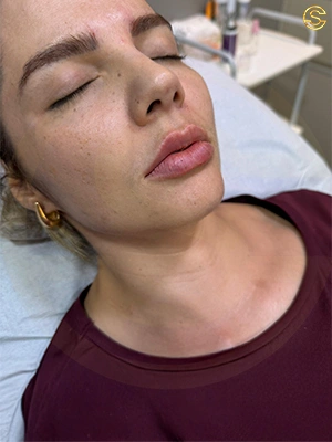 Foto antes e depois