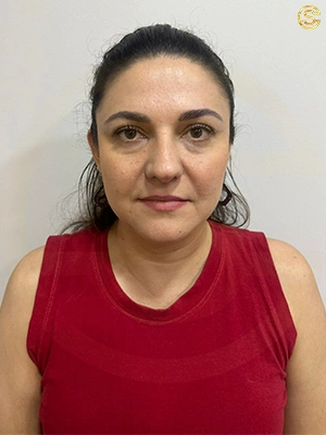 Foto antes e depois