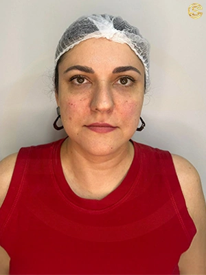 Foto antes e depois
