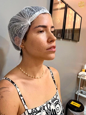 Foto antes e depois