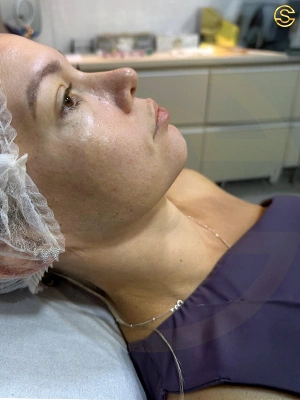 Foto antes e depois