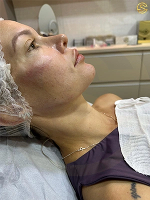Foto antes e depois