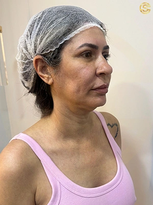 Foto antes e depois