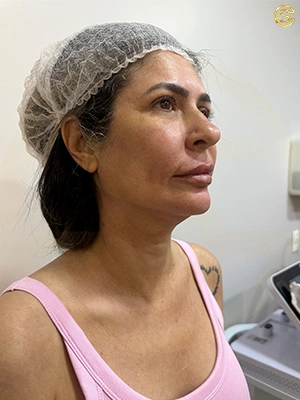 Foto antes e depois