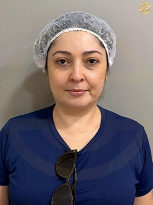 Foto antes e depois