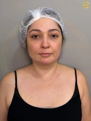 Foto antes e depois