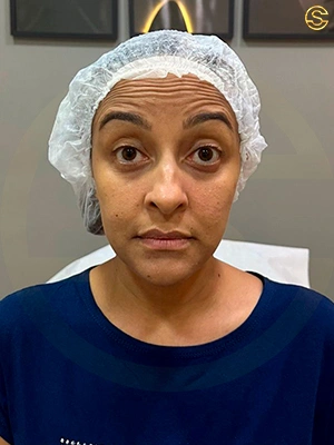 Foto antes e depois