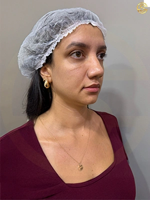 Foto antes e depois