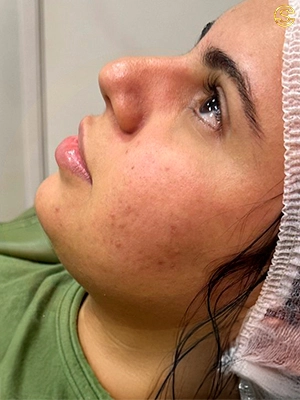 Foto antes e depois