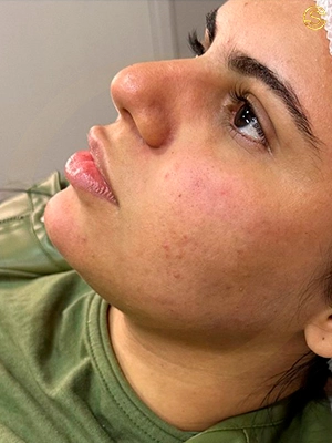 Foto antes e depois