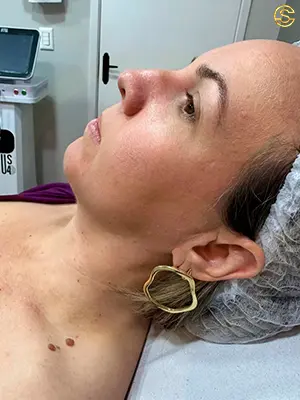 Foto antes e depois