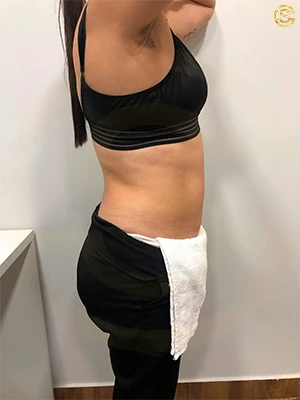 Foto antes e depois