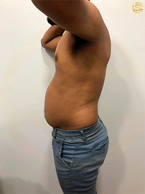Foto antes e depois