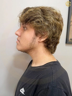 Foto antes e depois