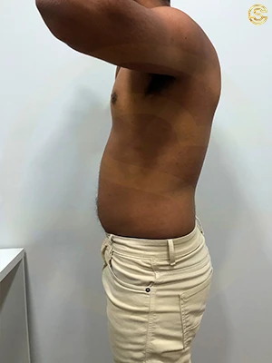 Foto antes e depois
