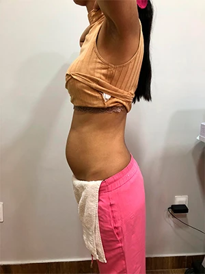 Foto antes e depois