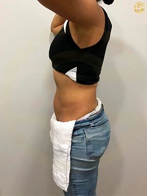 Foto antes e depois