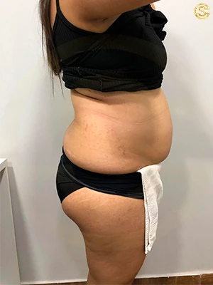 Foto antes e depois