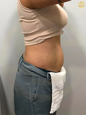 Foto antes e depois