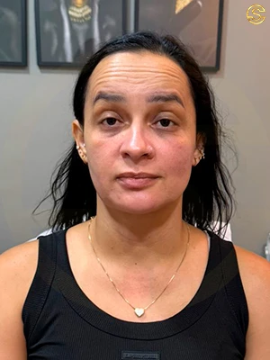 Foto antes e depois