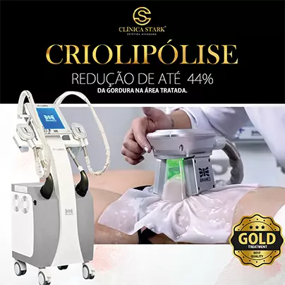 Tratamento estético de para gordura localizada com criolipólise