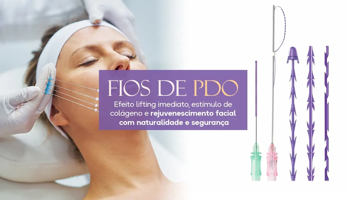 Fio de PDO - efeito lifting imediato